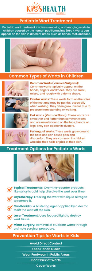 Warts can occur in a variety of ways, including big, hard lumps and flat, glossy or long stalks. They can be unpleasant at times, especially when they are on the feet or under nails. Dr. Maria Nabong and her team of experienced pediatricians offer safe and effective treatments for warts. For more information, contact us today or book an appointment online. We have convenient locations in Scottsdale, and Glendale AZ. Warts can occur in a variety of ways, including big, hard lumps and flat, glossy or long stalks. They can be unpleasant at times, especially when they are on the feet or under nails. Dr. Maria Nabong and her team of experienced pediatricians offer safe and effective treatments for warts. For more information, contact us today or book an appointment online. We have convenient locations in Scottsdale, and Glendale AZ.